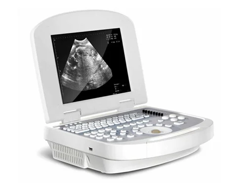 Laptop Full Digital Ultrasound Scanner — view 2