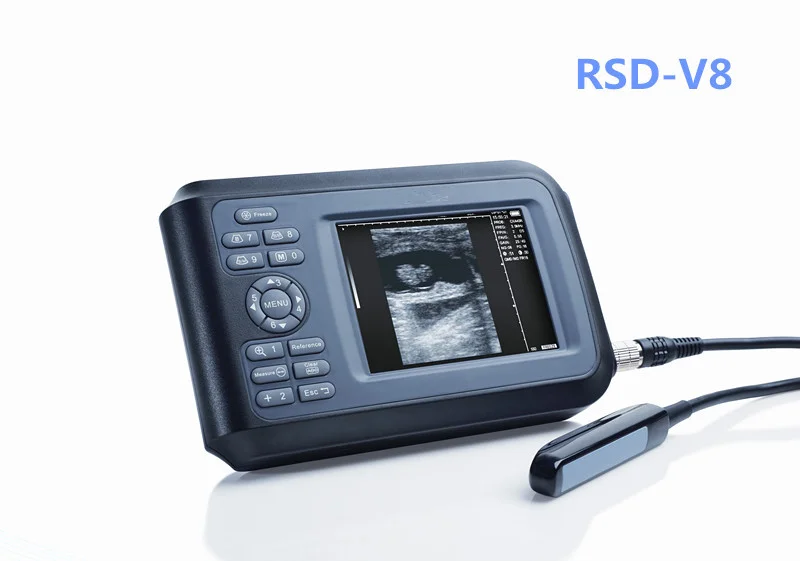 Handheld Veterinary Ultrasound Scanner — view 2