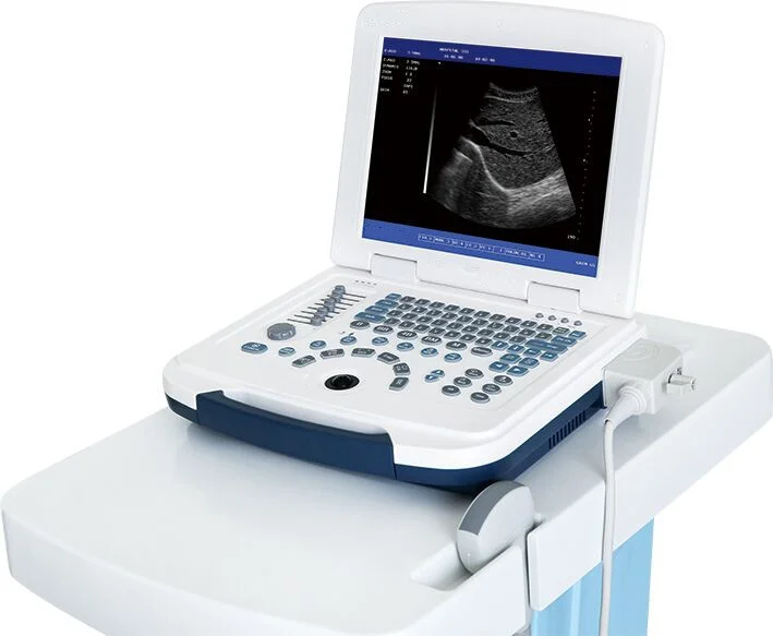 Full Digital Laptop Ultrasound Scanner — view 2
